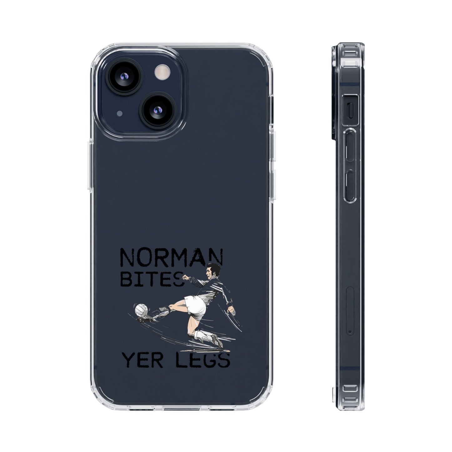 Leeds United Norman Bites 'YER  LEGS' Clear Impact-Resistant Case