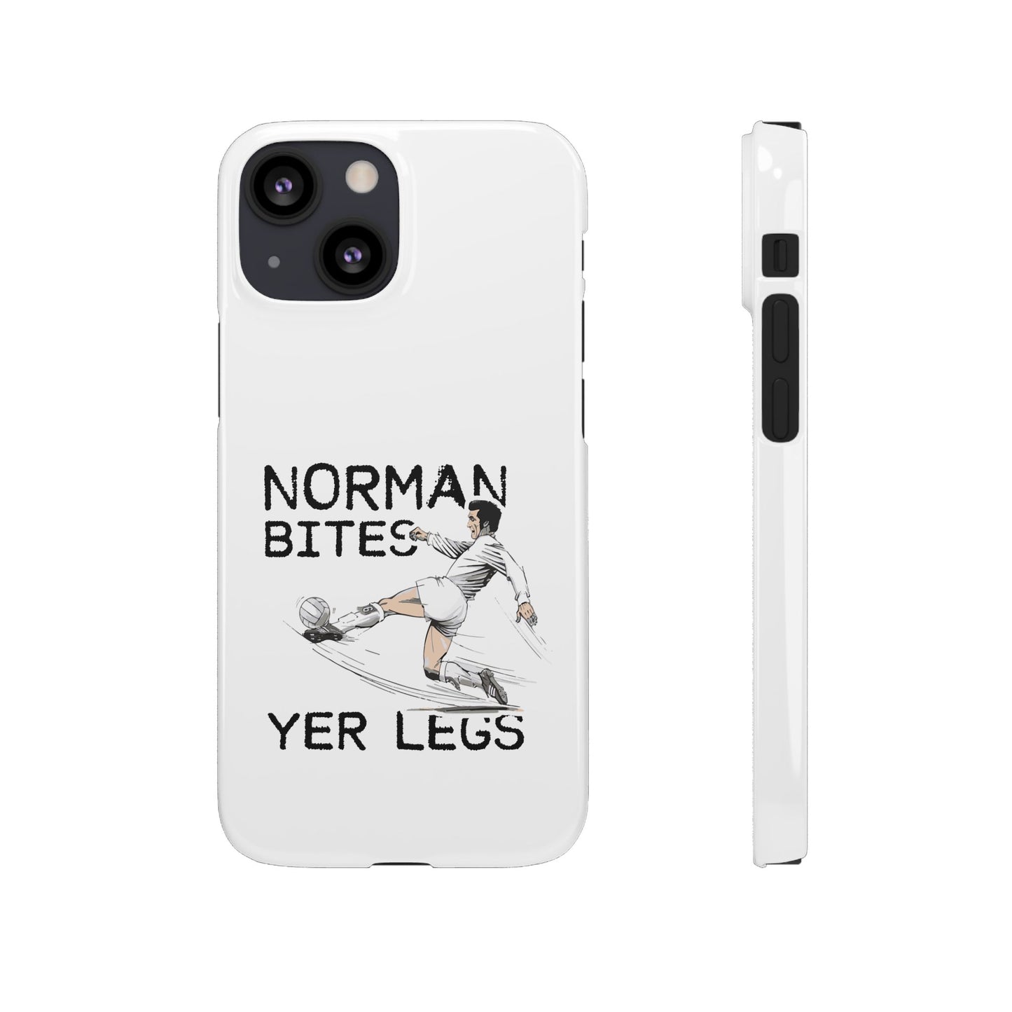 Leeds United Norman Bites "YER  LEGS" Snap Case