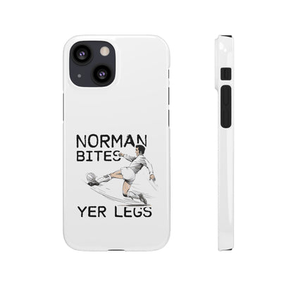 Leeds United Norman Bites "YER  LEGS" Snap Case