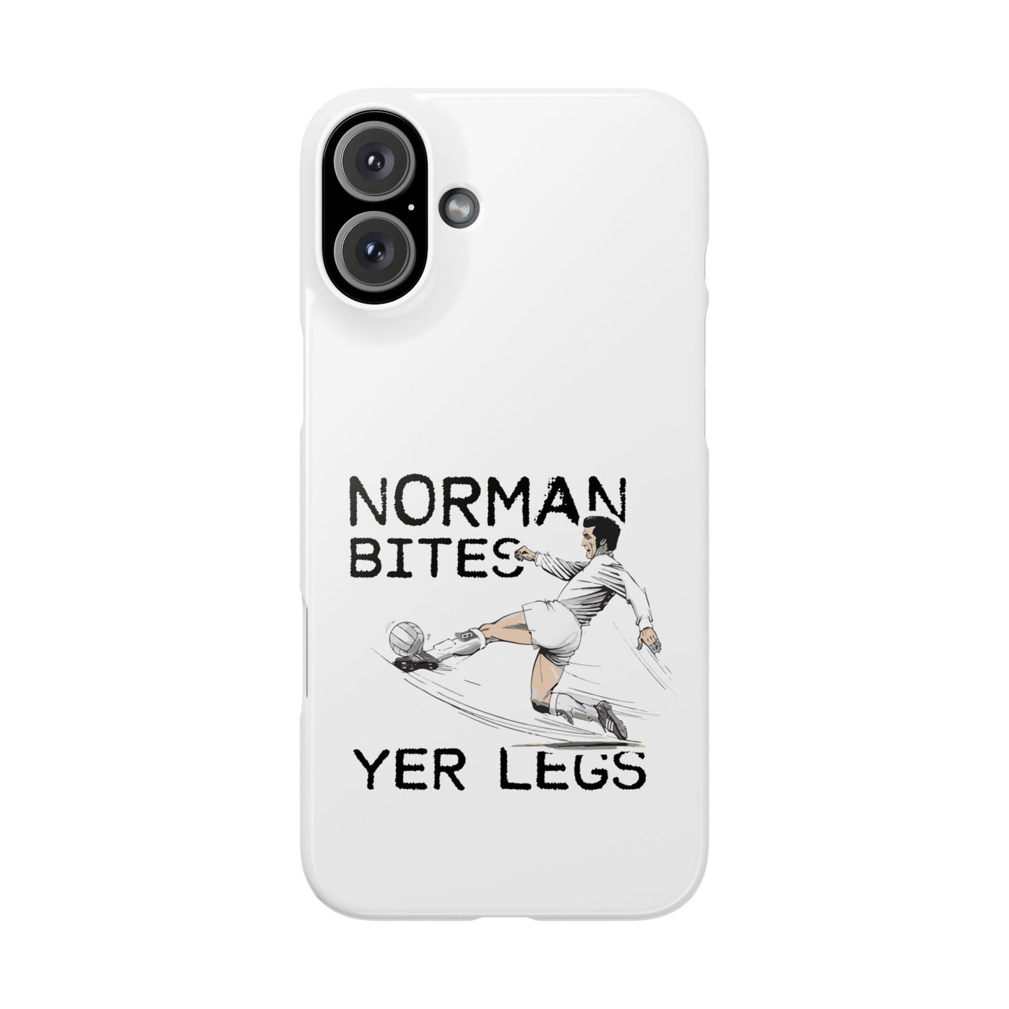 Leeds United Norman Bites "YER  LEGS" Snap Case