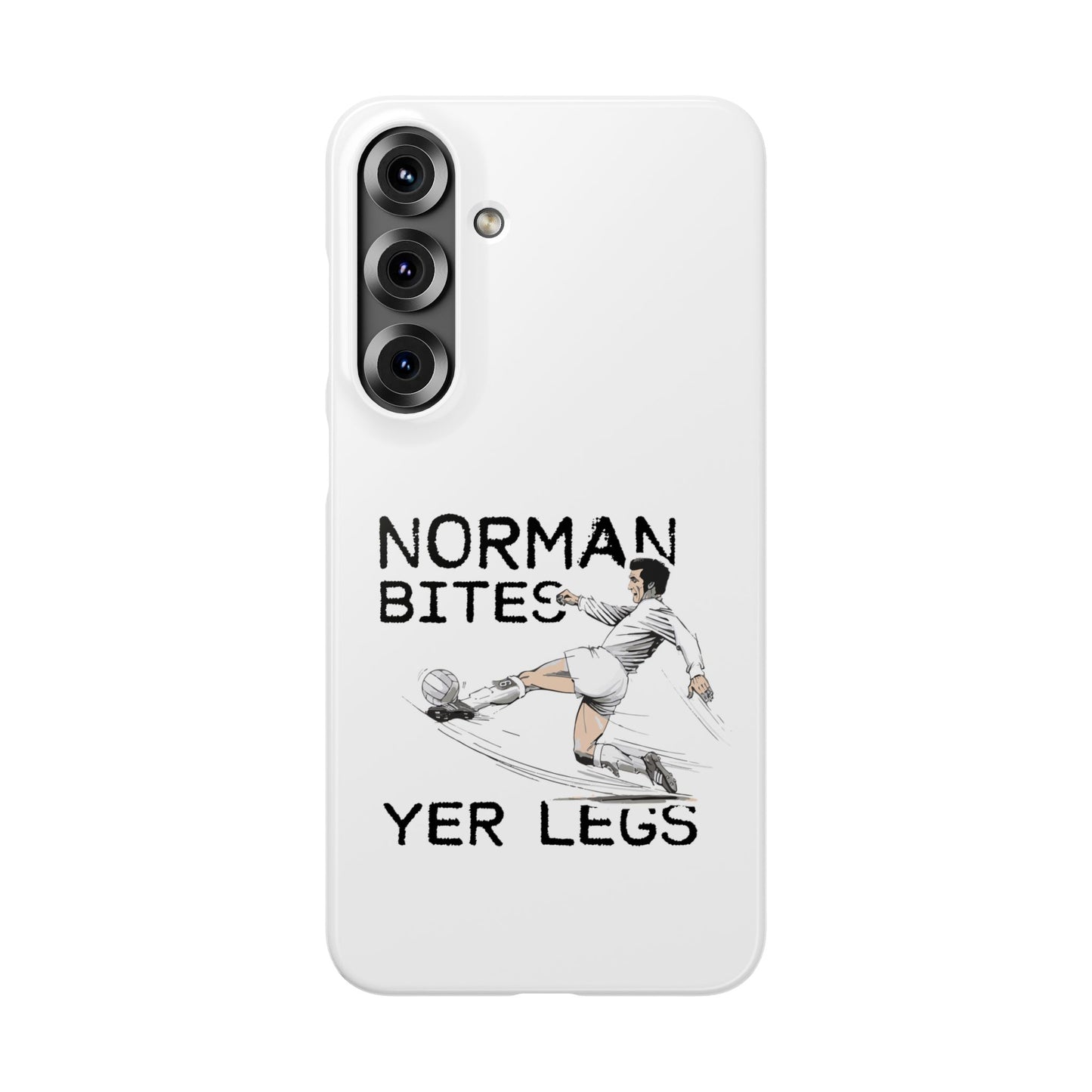 Leeds United Norman Bites "YER  LEGS" Snap Case