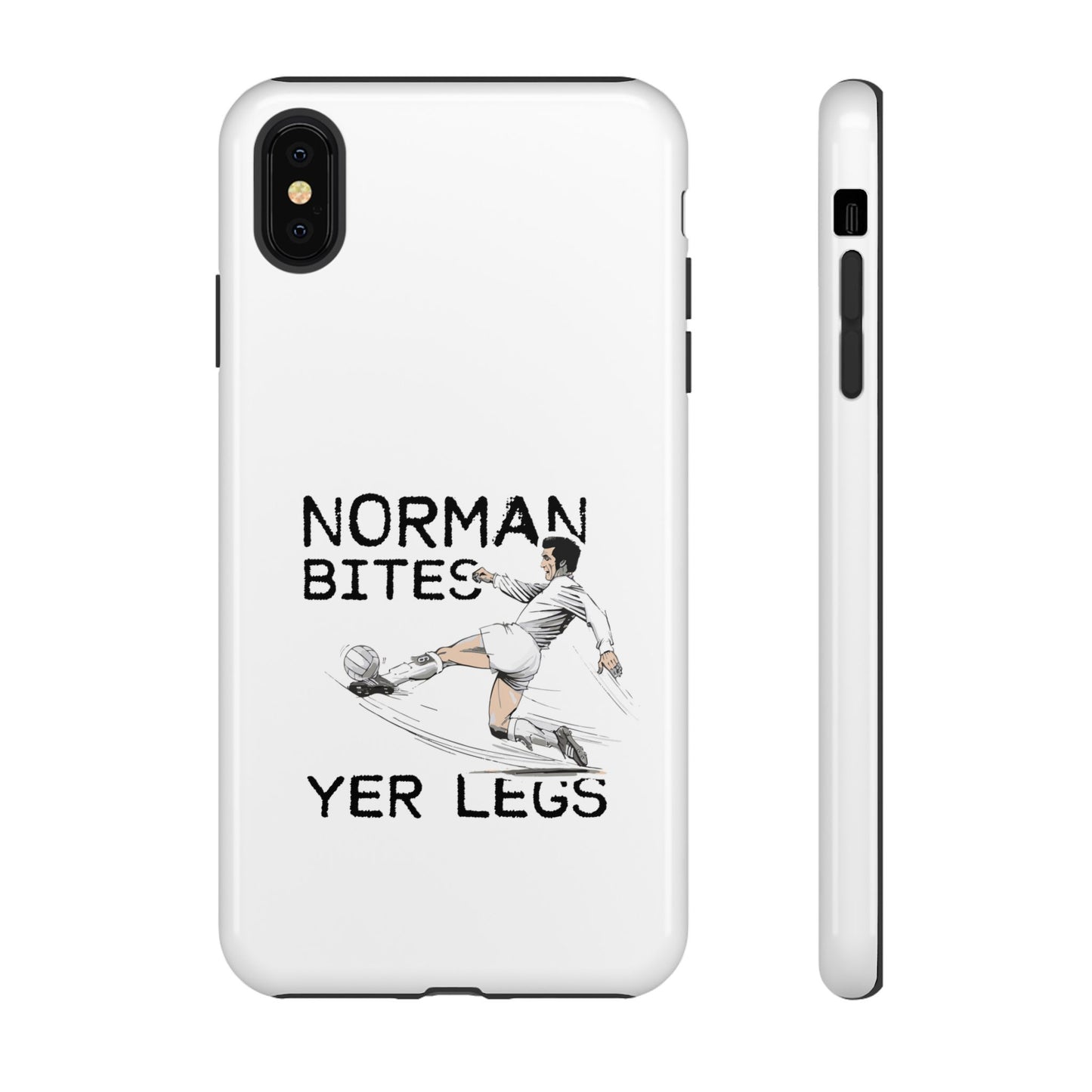 Leeds United NORMAN BITES 'YER  LEGS' Phone Case