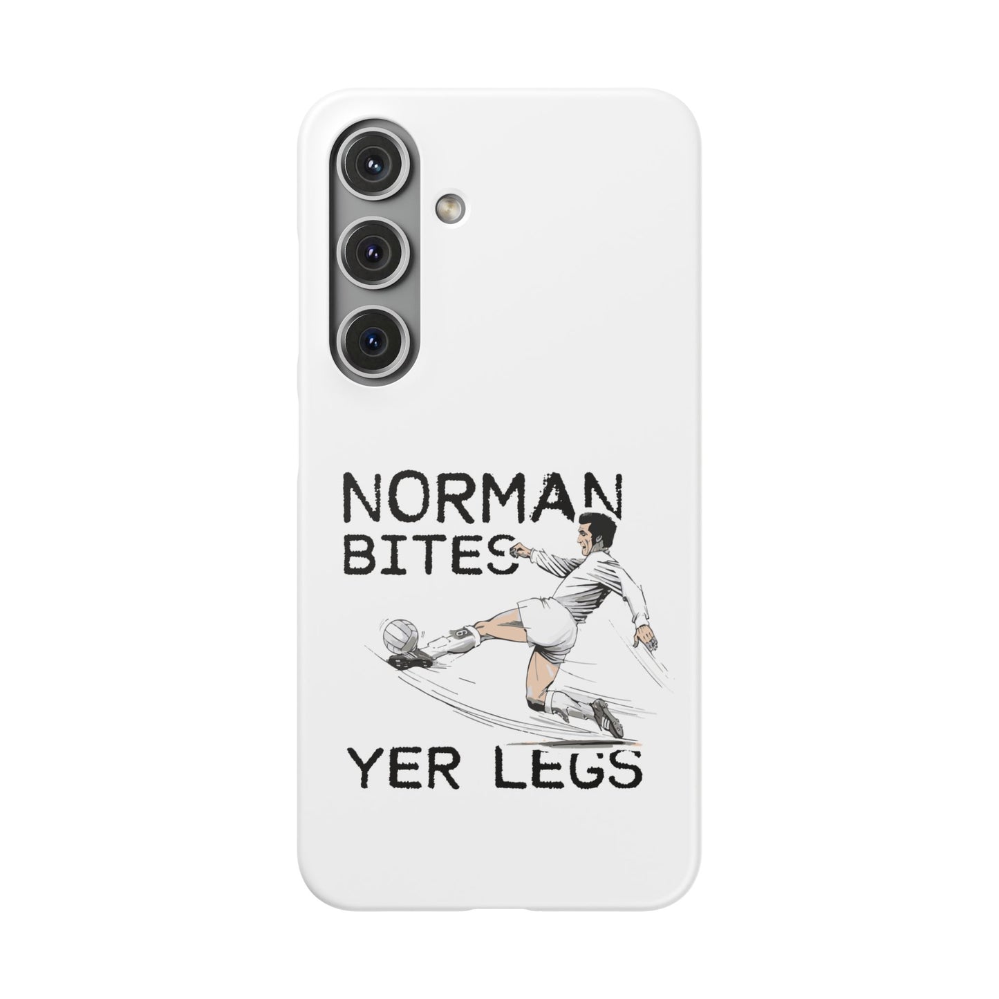 Leeds United Norman Bites "YER  LEGS" Snap Case