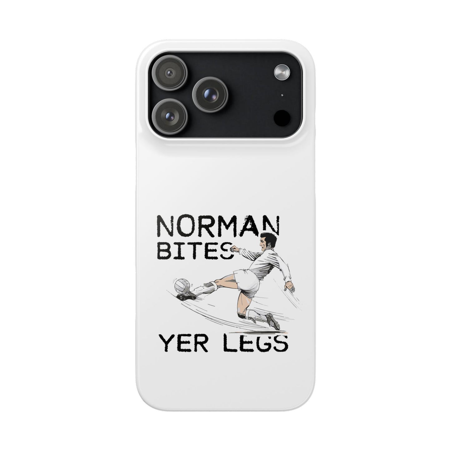 Leeds United Norman Bites "YER  LEGS" Snap Case