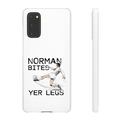 Leeds United Norman Bites "YER  LEGS" Snap Case