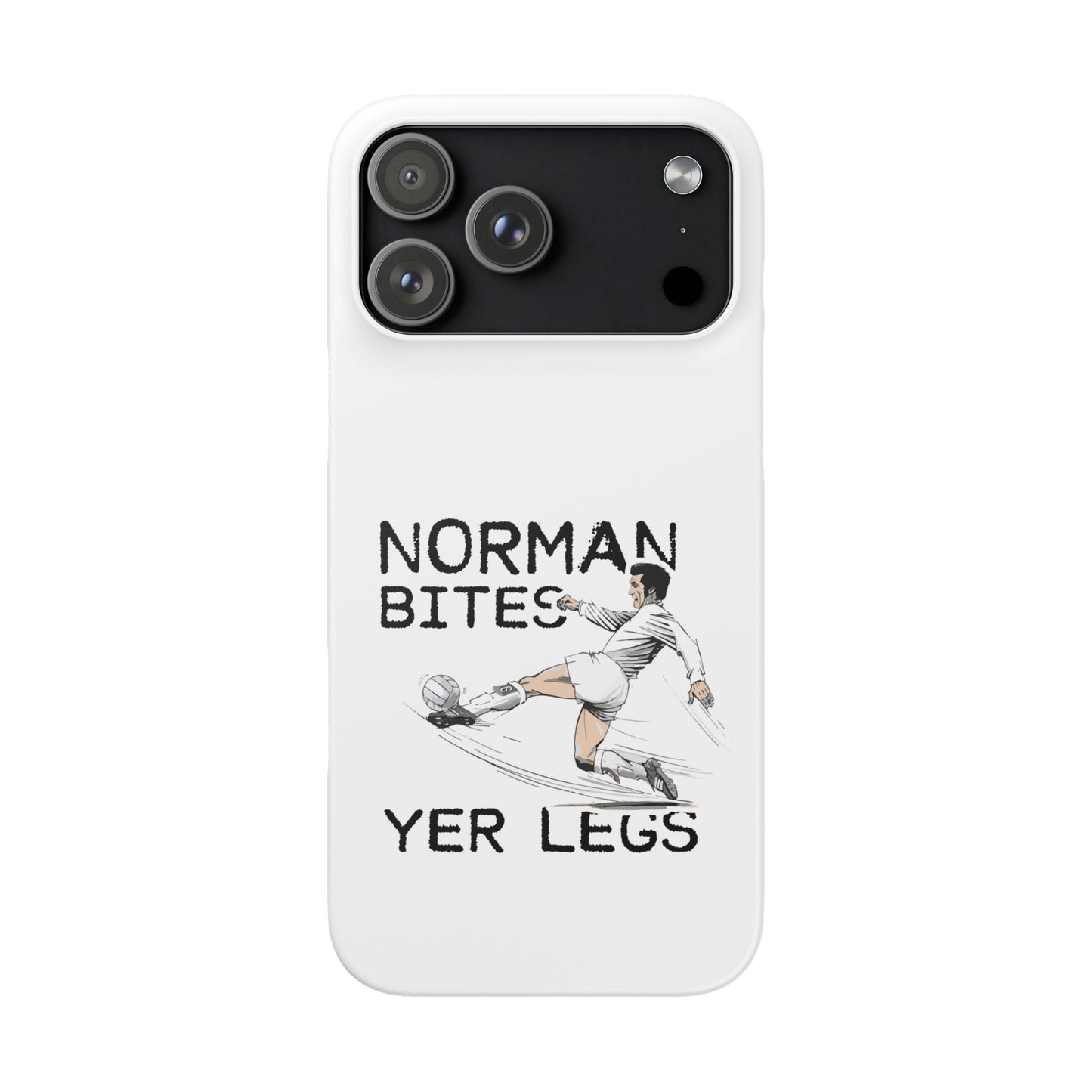 Leeds United Norman Bites "YER  LEGS" Snap Case