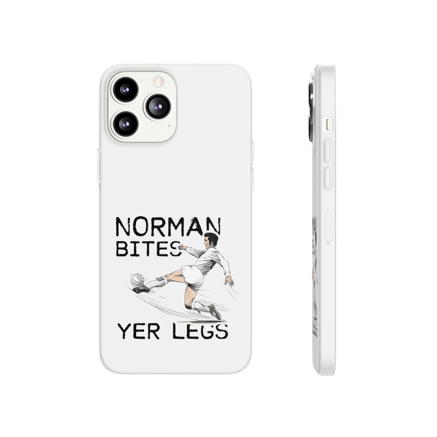 LUFC Norman Bites 'YER LEGS’ Flexi  Case