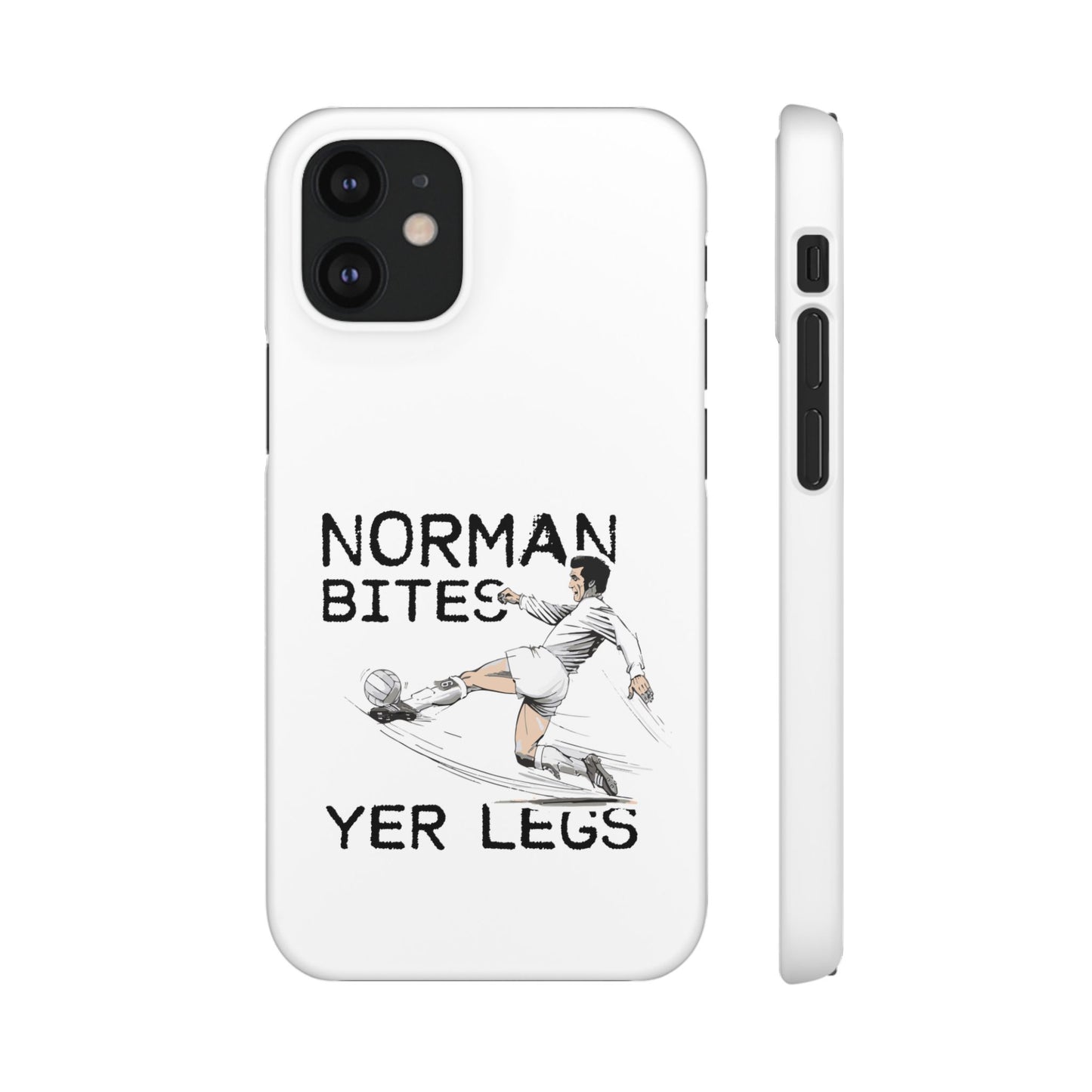 Leeds United Norman Bites "YER  LEGS" Snap Case