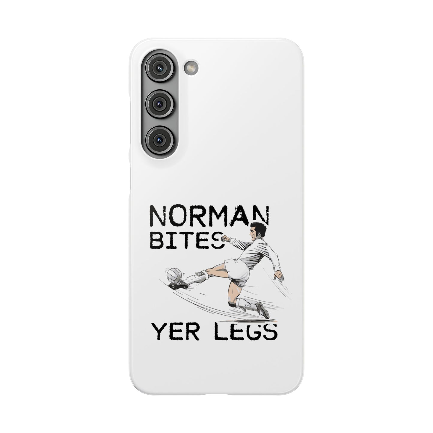 Leeds United Norman Bites "YER  LEGS" Snap Case