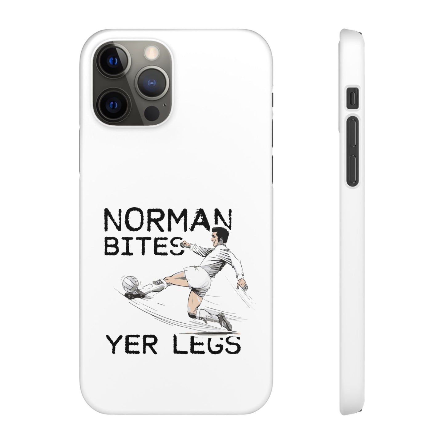 Leeds United Norman Bites "YER  LEGS" Snap Case