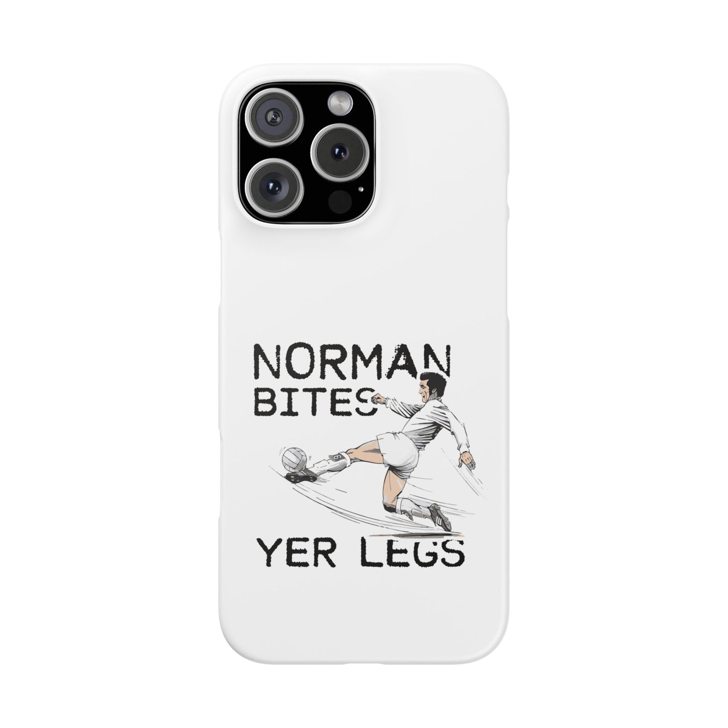 Leeds United Norman Bites "YER  LEGS" Snap Case
