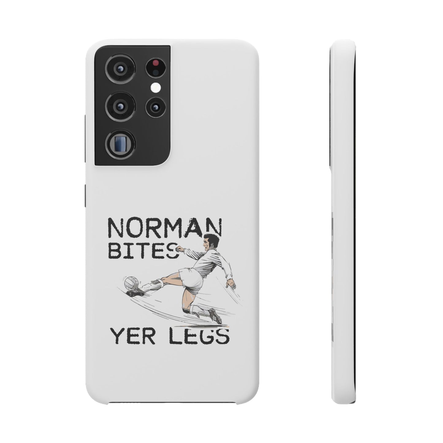 Leeds United Norman Bites "YER  LEGS" Snap Case
