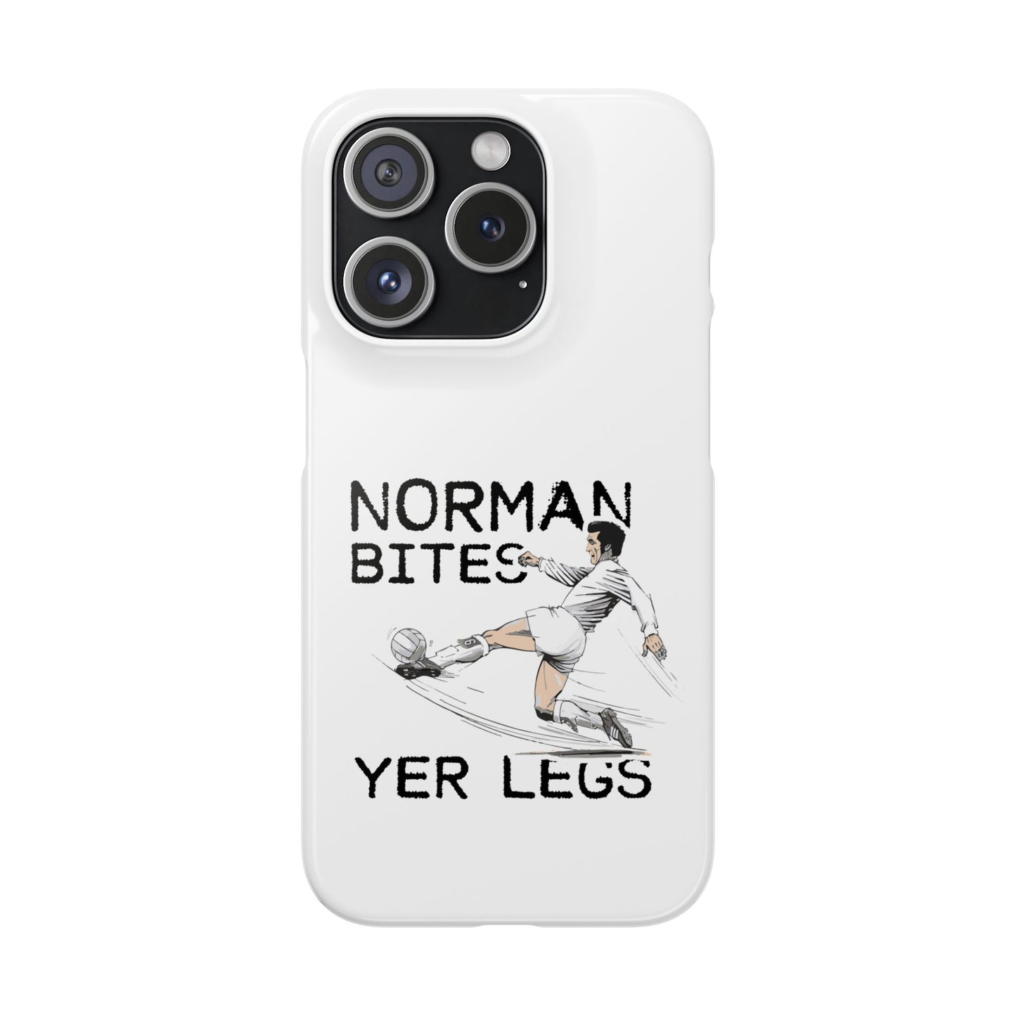 Leeds United Norman Bites "YER  LEGS" Snap Case