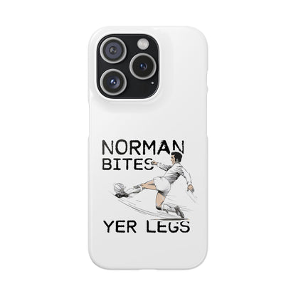 Leeds United Norman Bites "YER  LEGS" Snap Case