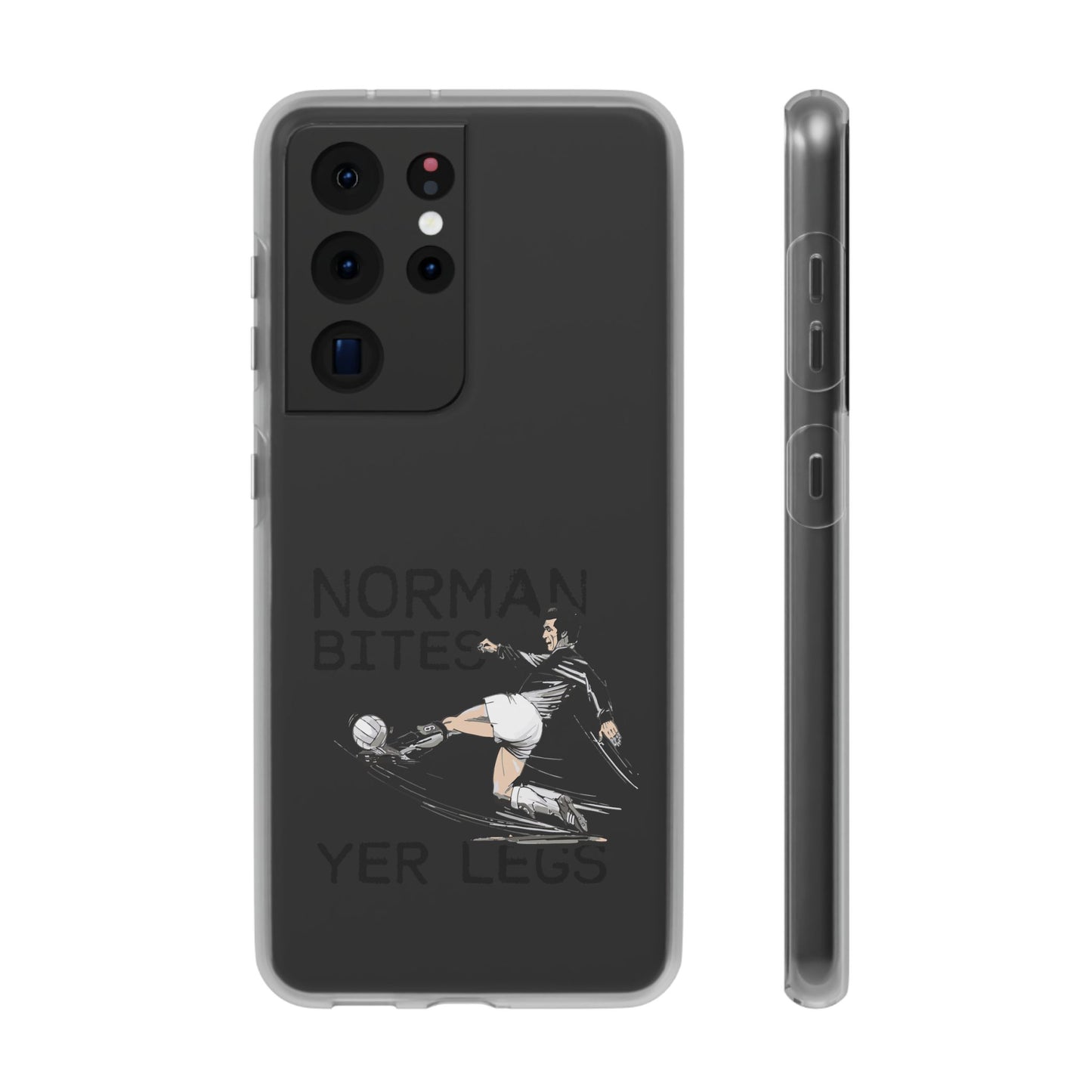 LUFC Norman Bites 'YER LEGS’ Flexi  Case