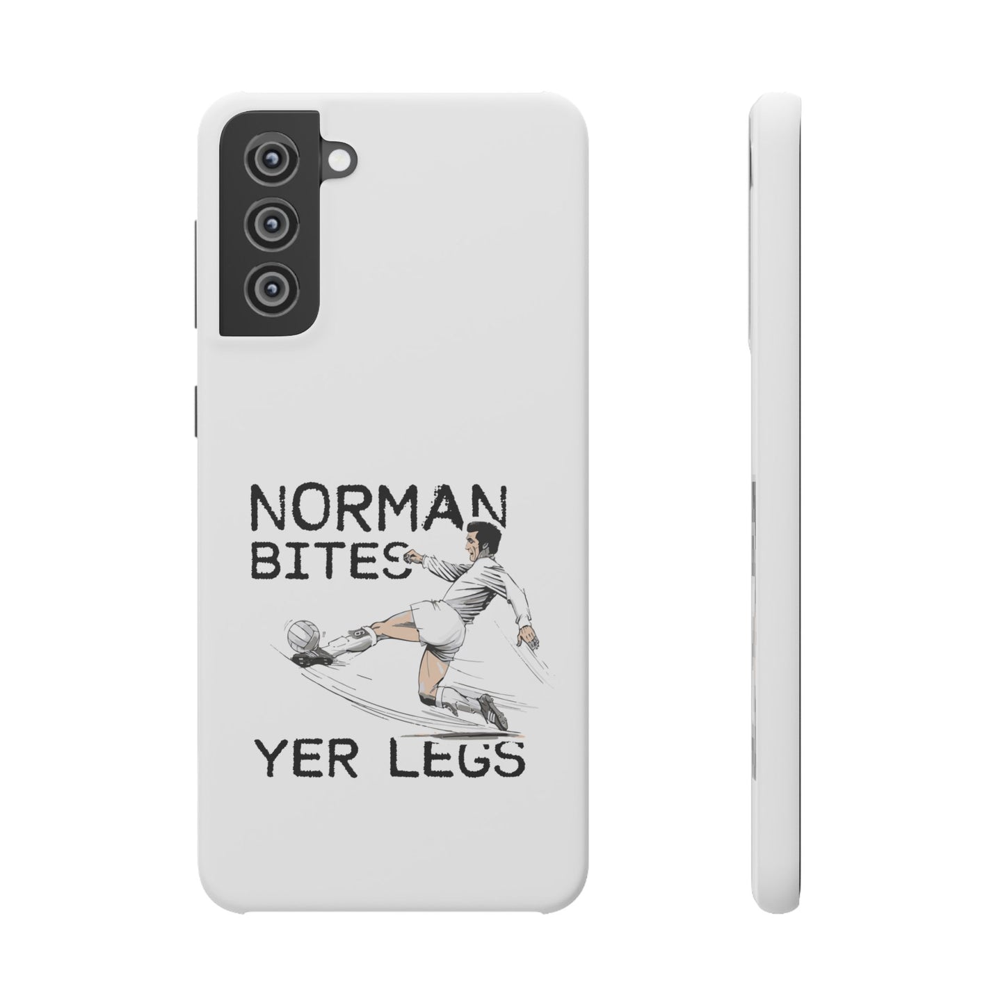 Leeds United Norman Bites "YER  LEGS" Snap Case