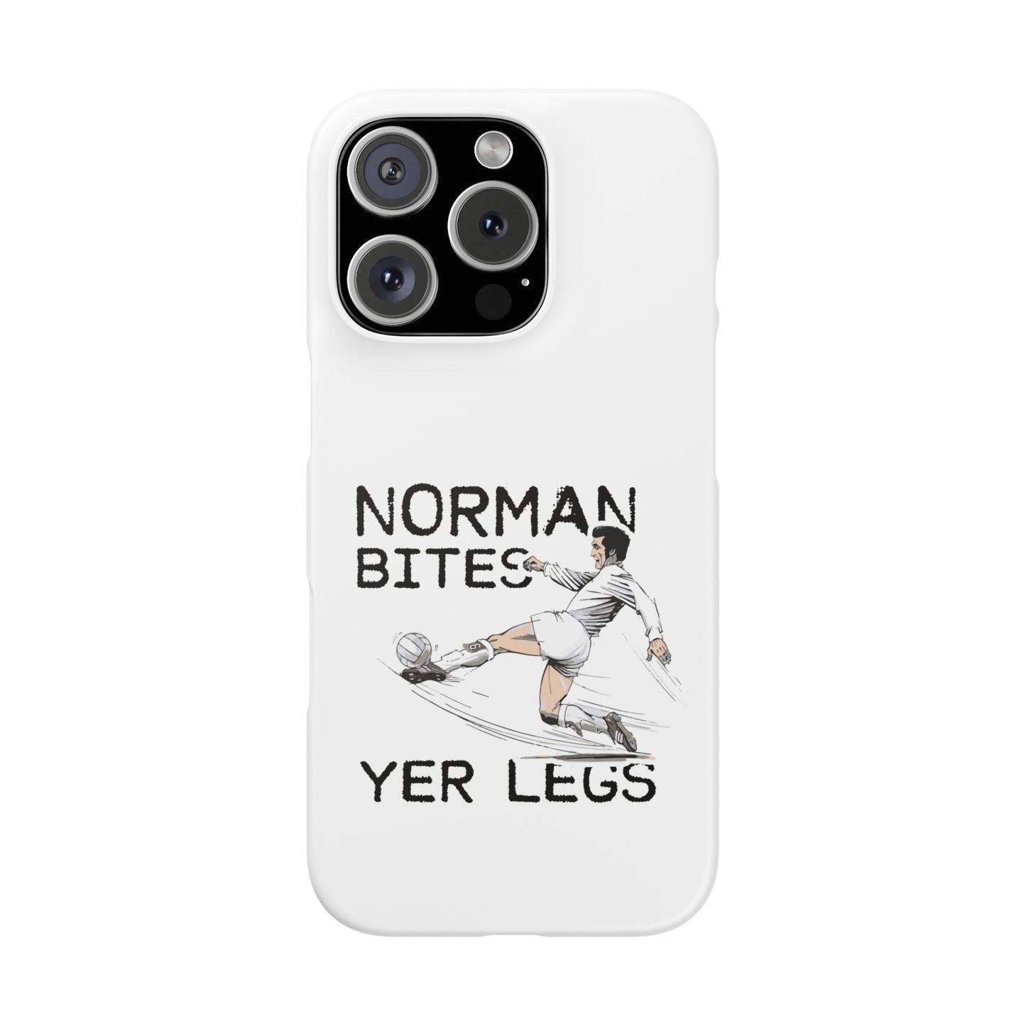 Leeds United Norman Bites "YER  LEGS" Snap Case