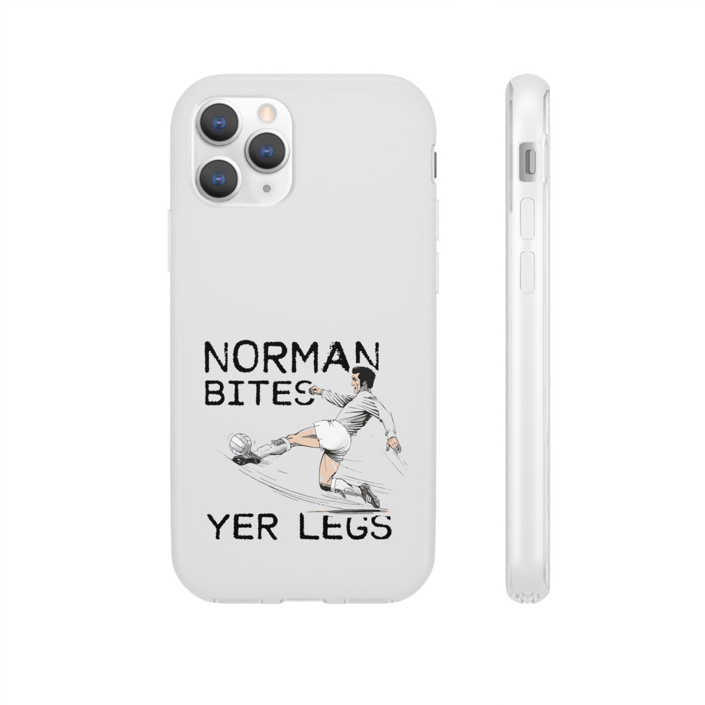 LUFC Norman Bites 'YER LEGS’ Flexi  Case