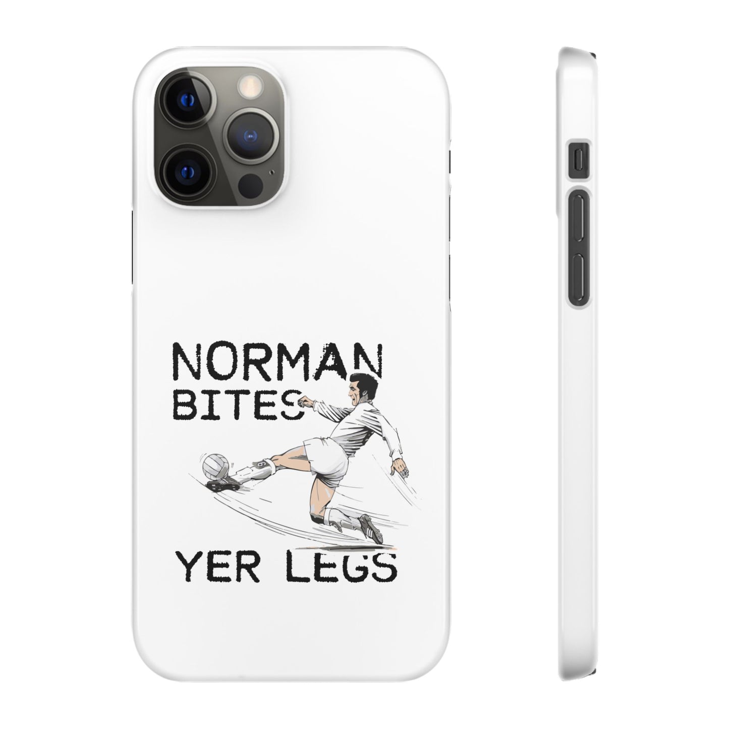 Leeds United Norman Bites "YER  LEGS" Snap Case