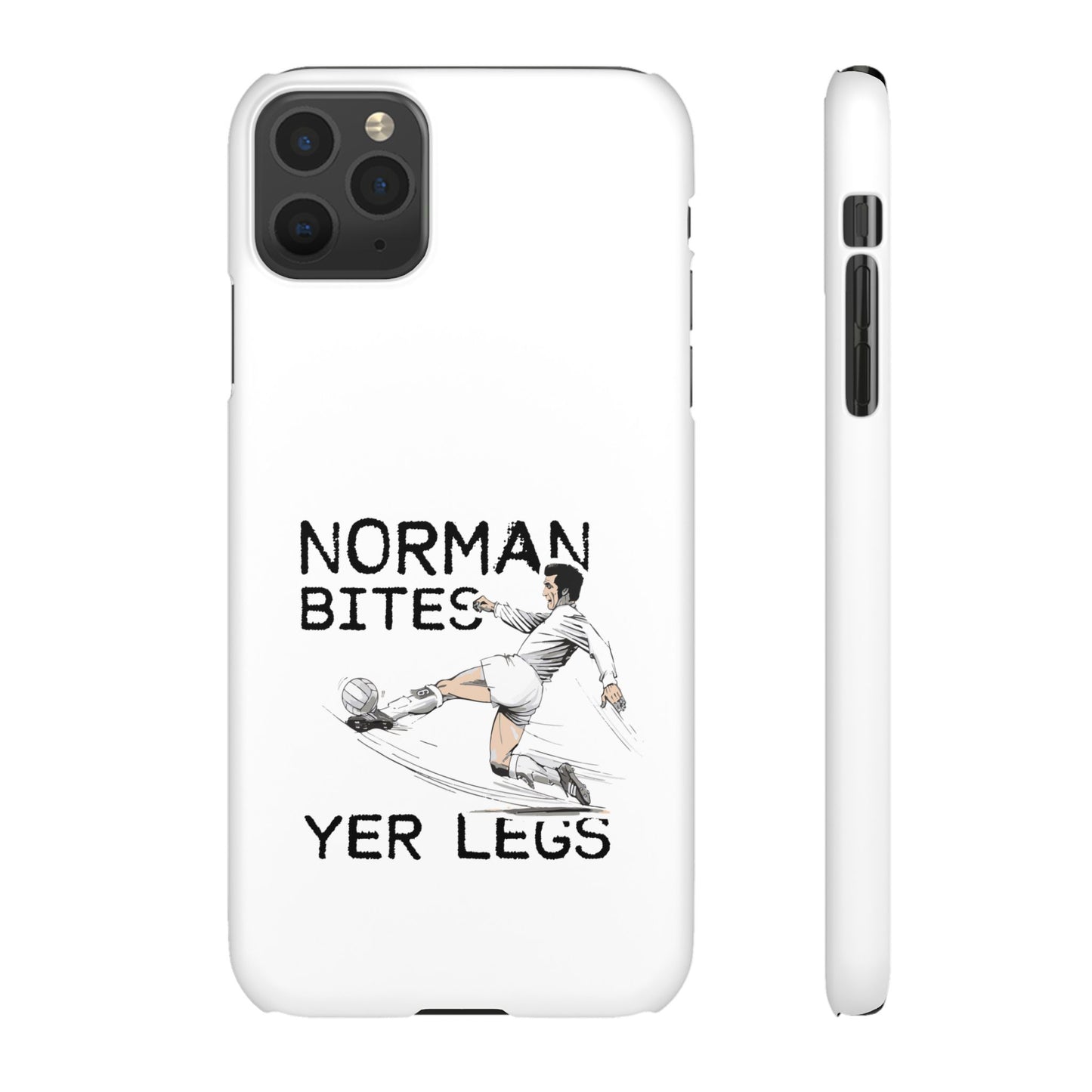 Leeds United Norman Bites "YER  LEGS" Snap Case