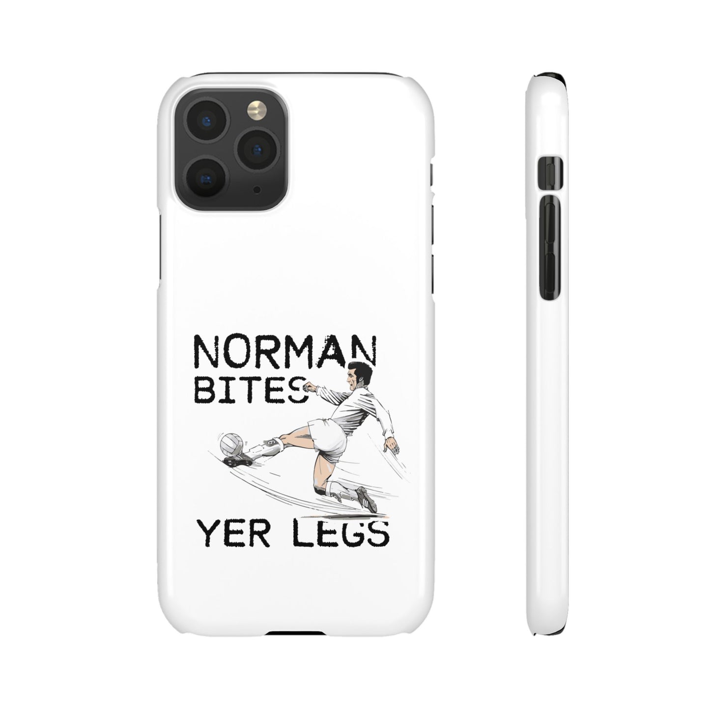 Leeds United Norman Bites "YER  LEGS" Snap Case