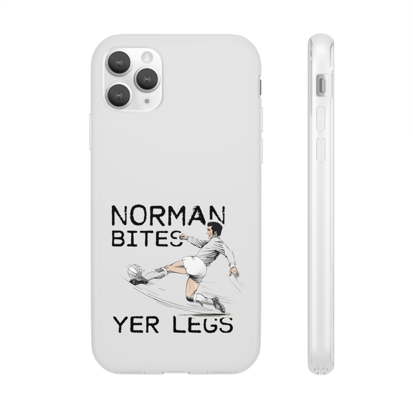 LUFC Norman Bites 'YER LEGS’ Flexi  Case