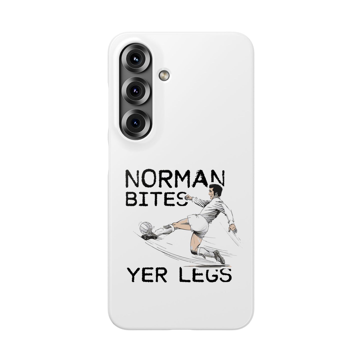 Leeds United Norman Bites "YER  LEGS" Snap Case