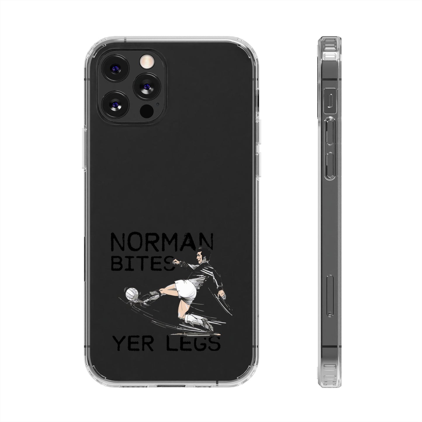 Leeds United Norman Bites 'YER  LEGS' Clear Impact-Resistant Case