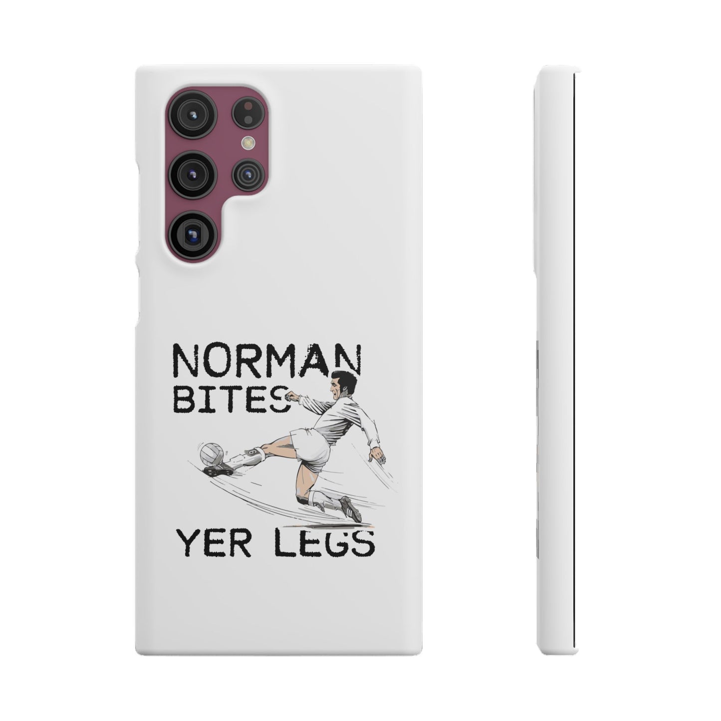 Leeds United Norman Bites "YER  LEGS" Snap Case