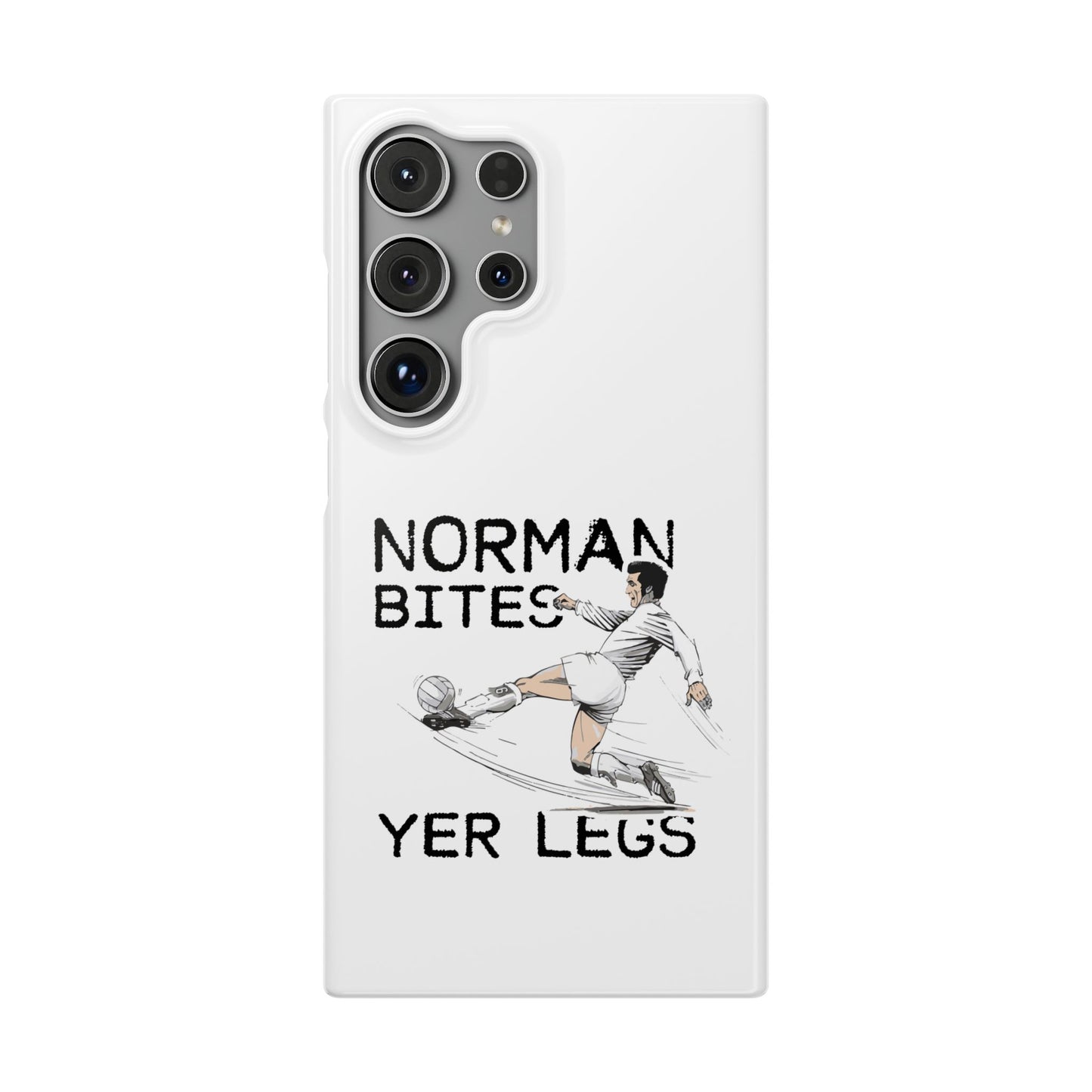 Leeds United Norman Bites "YER  LEGS" Snap Case