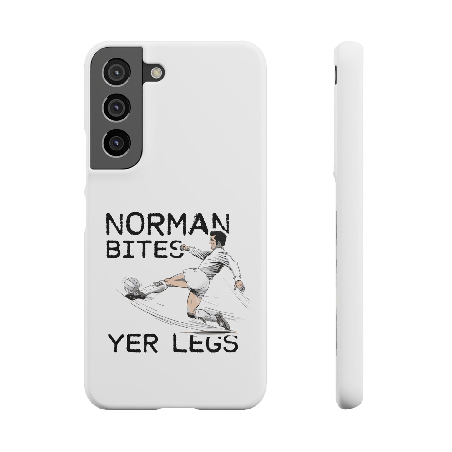 Leeds United Norman Bites "YER  LEGS" Snap Case