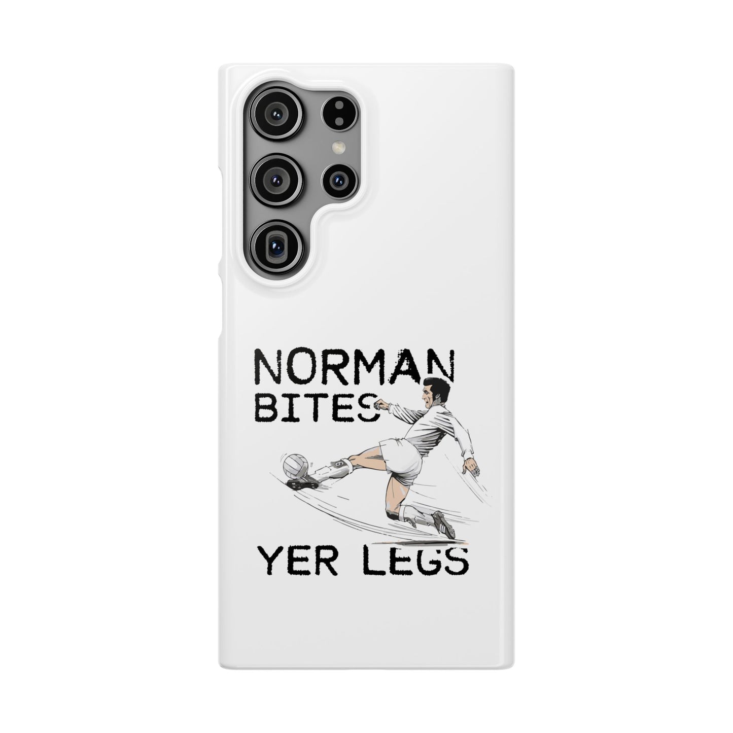 Leeds United Norman Bites "YER  LEGS" Snap Case