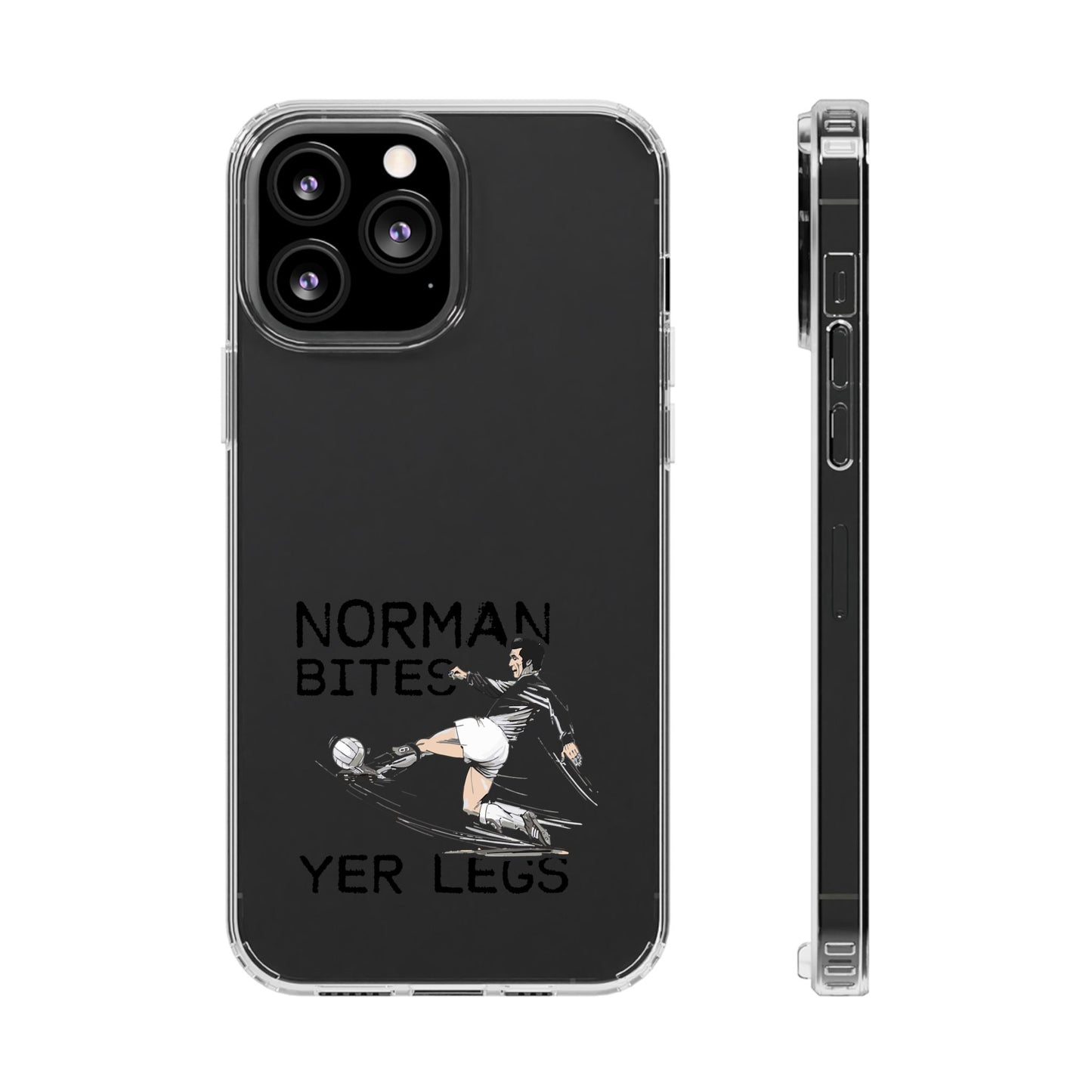 Leeds United Norman Bites 'YER  LEGS' Clear Impact-Resistant Case