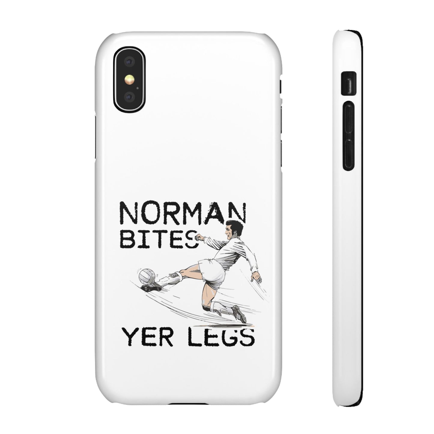 Leeds United Norman Bites "YER  LEGS" Snap Case
