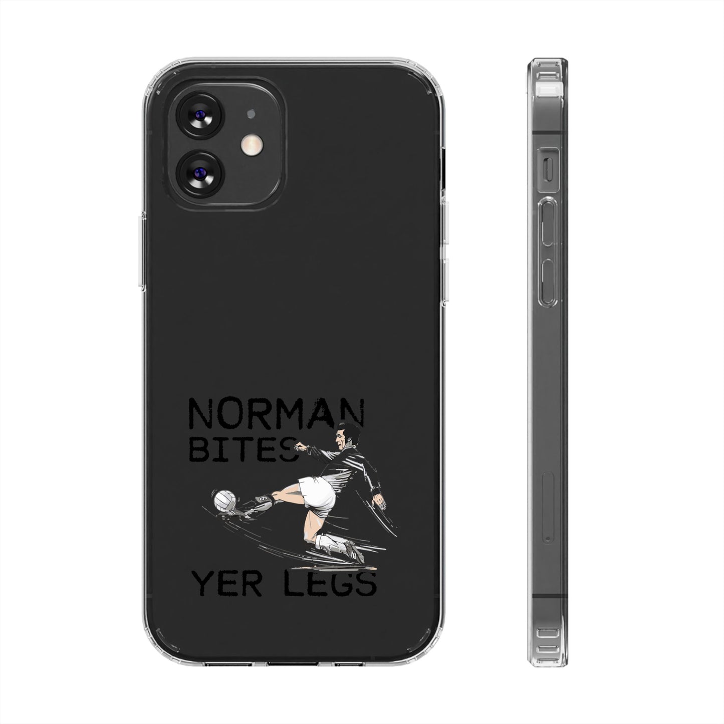 Leeds United Norman Bites 'YER  LEGS' Clear Impact-Resistant Case