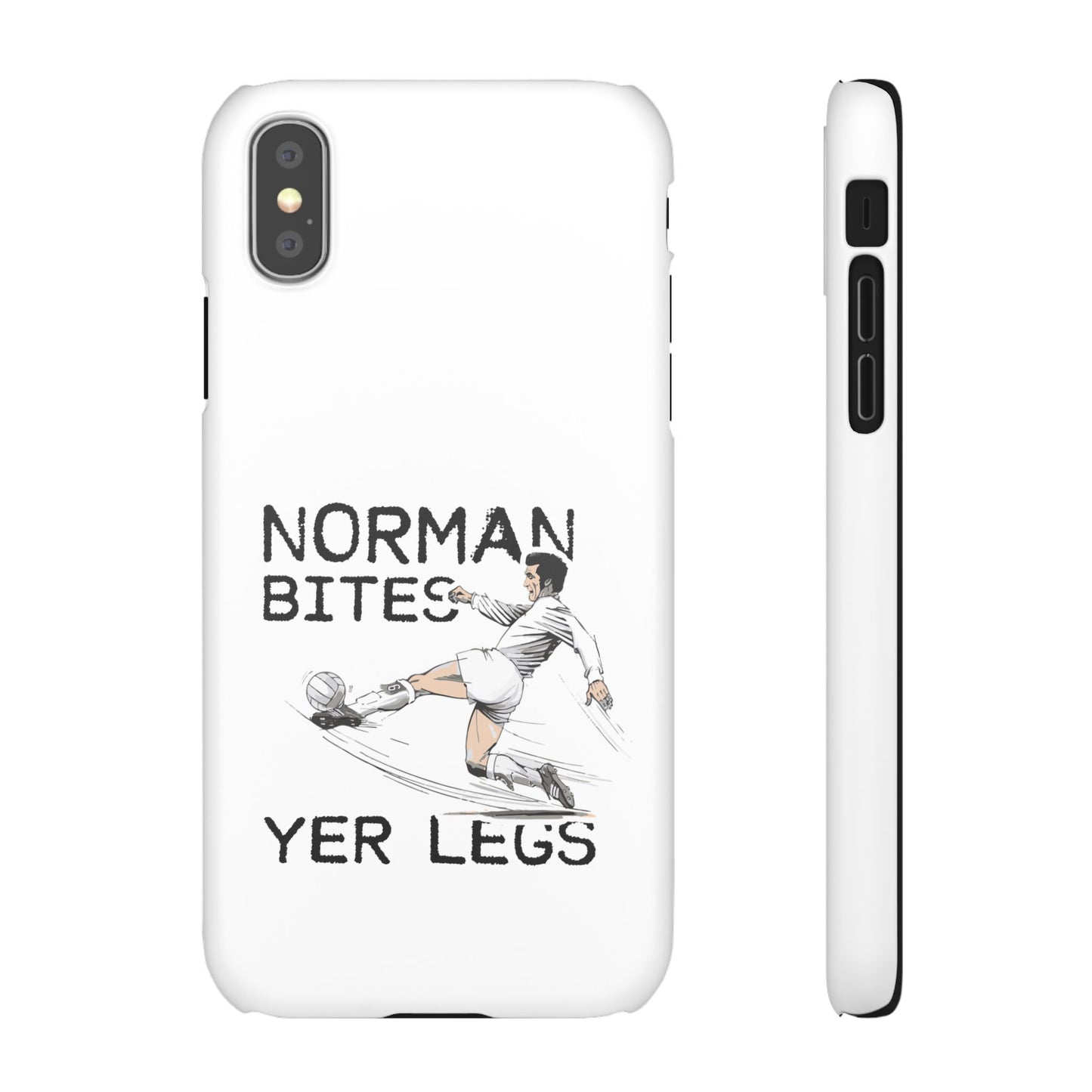 Leeds United Norman Bites "YER  LEGS" Snap Case