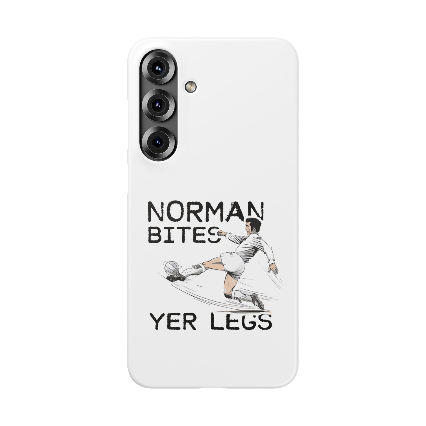 Leeds United Norman Bites "YER  LEGS" Snap Case