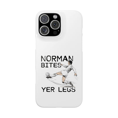 Leeds United Norman Bites "YER  LEGS" Snap Case