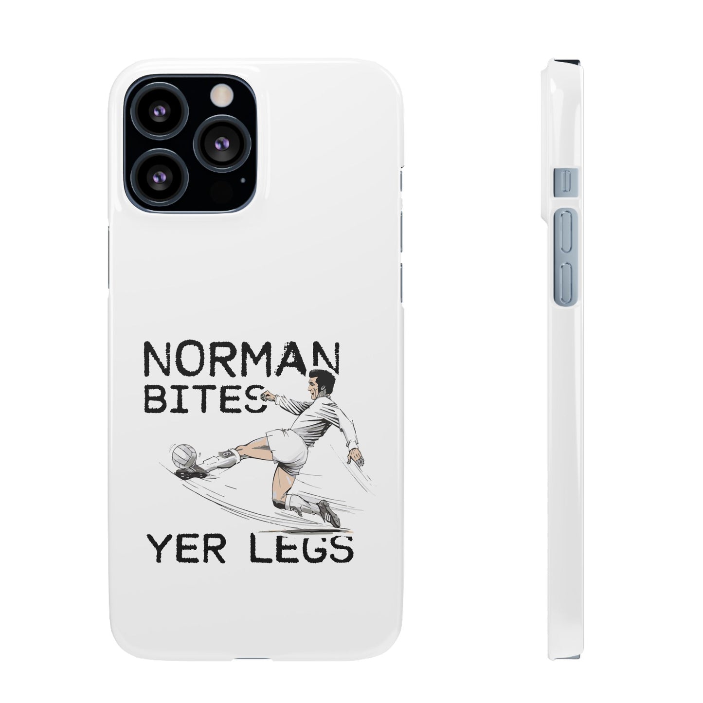 Leeds United Norman Bites "YER  LEGS" Snap Case