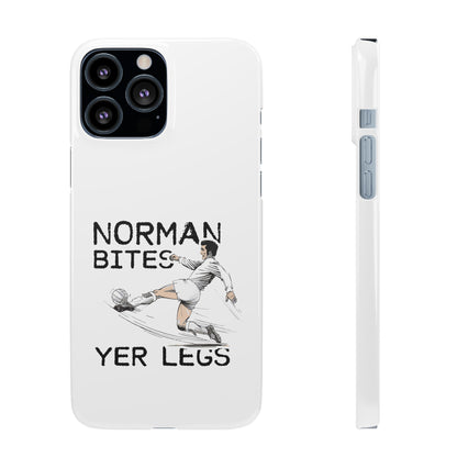 Leeds United Norman Bites "YER  LEGS" Snap Case