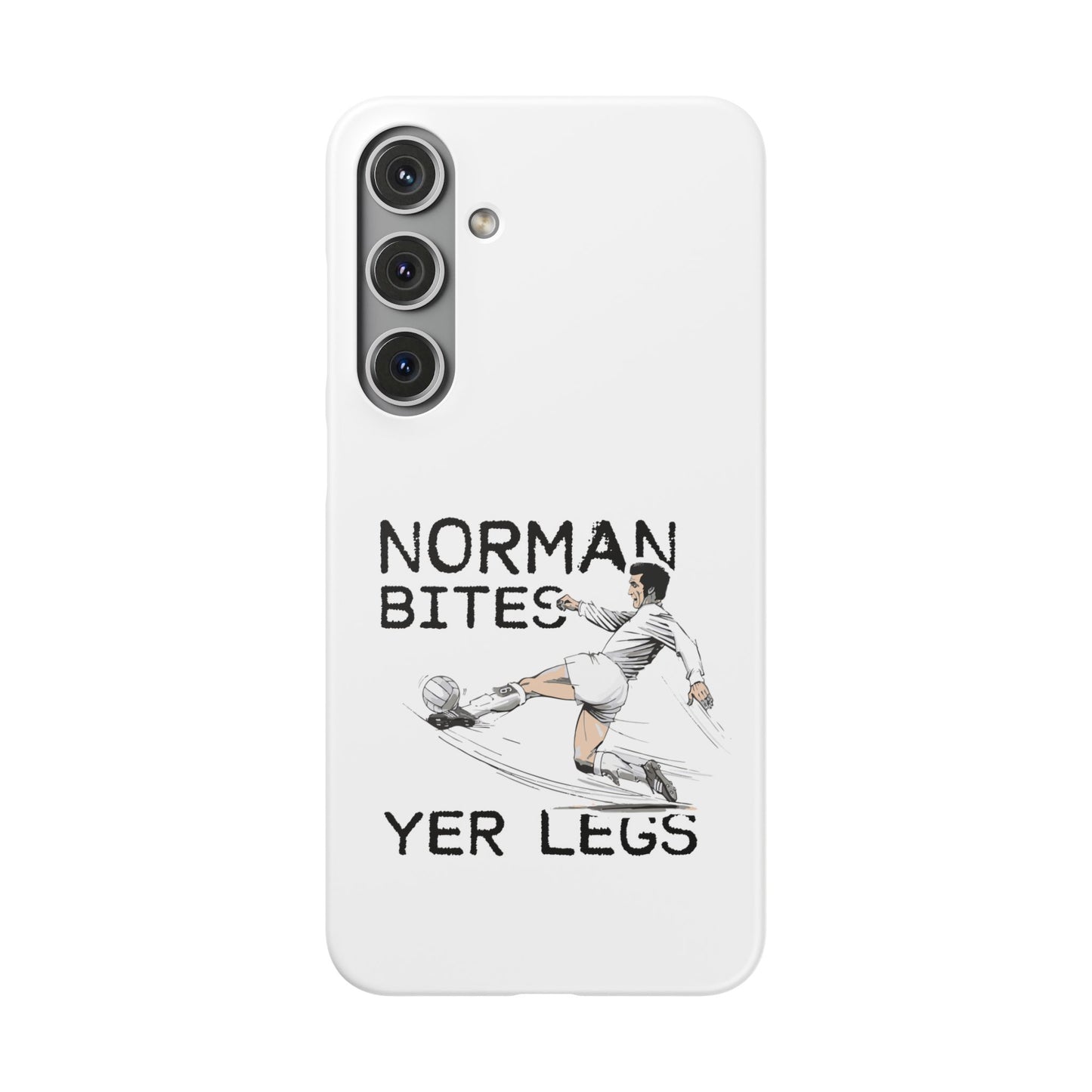 Leeds United Norman Bites "YER  LEGS" Snap Case