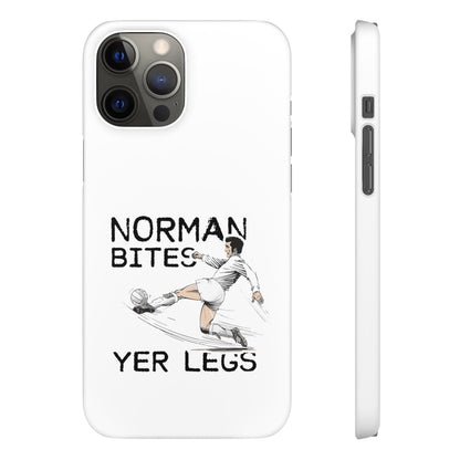 Leeds United Norman Bites "YER  LEGS" Snap Case