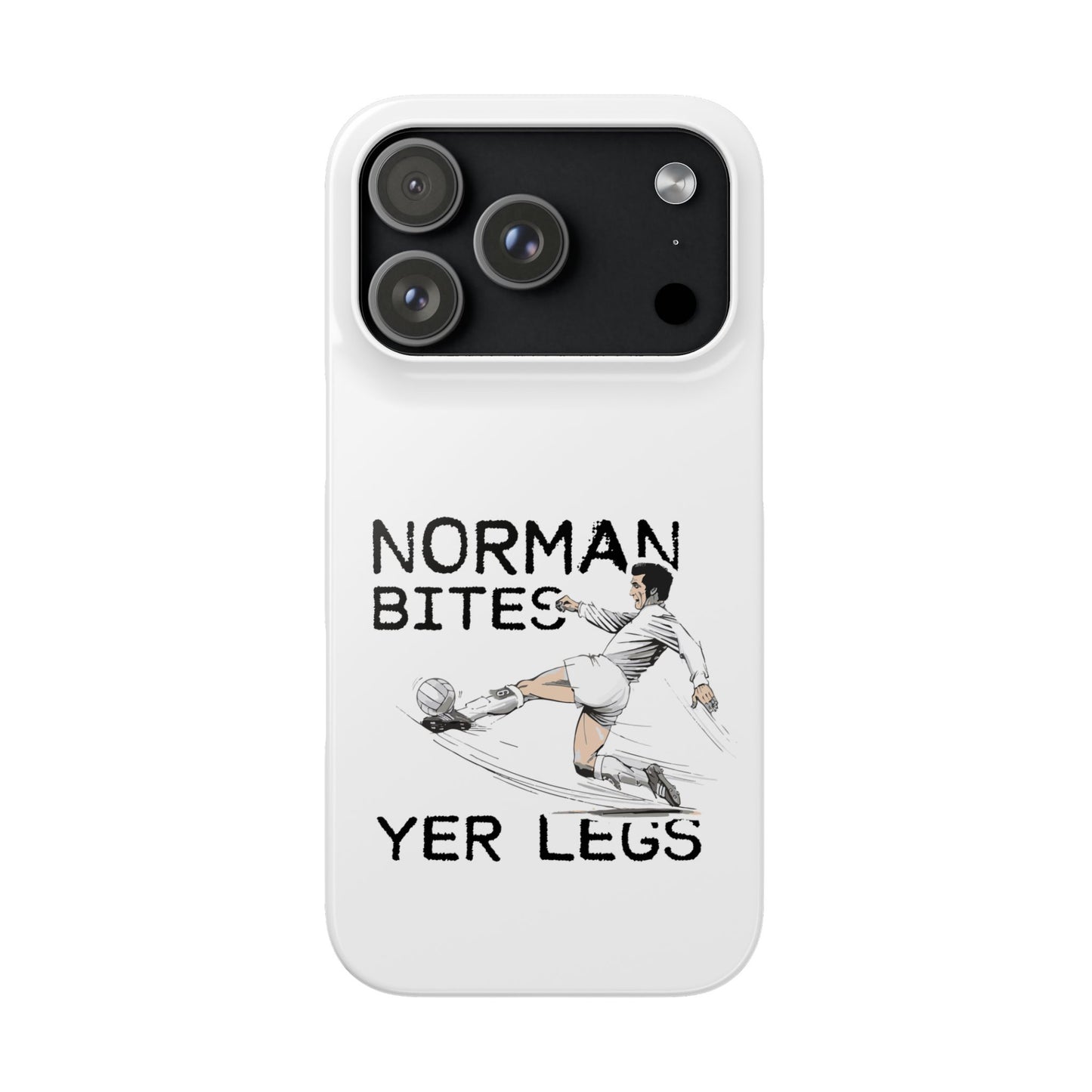 Leeds United Norman Bites "YER  LEGS" Snap Case