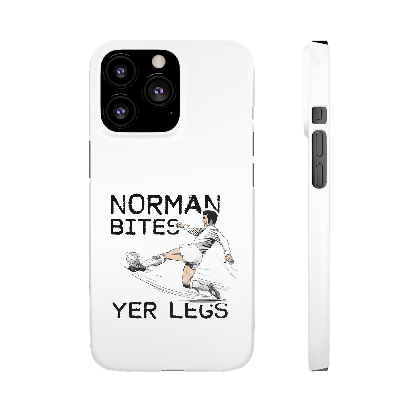 Leeds United Norman Bites "YER  LEGS" Snap Case