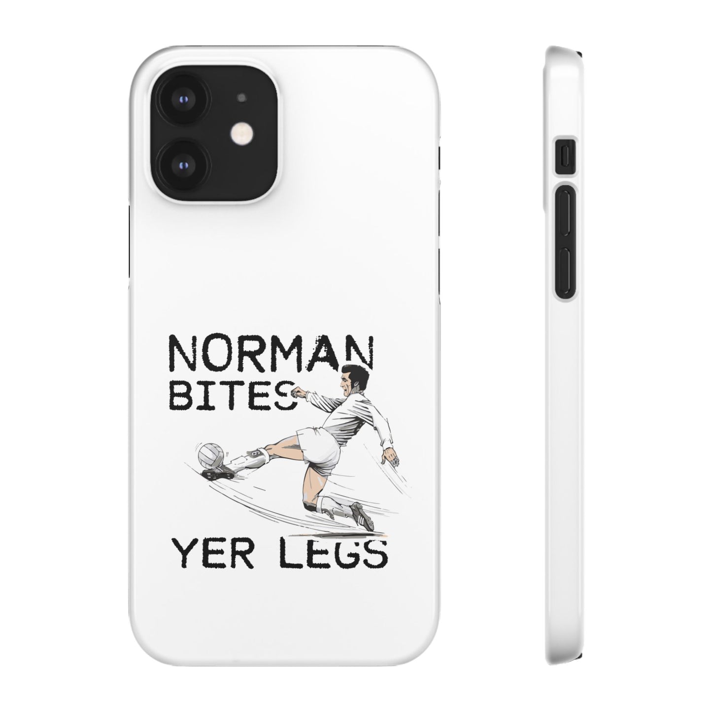 Leeds United Norman Bites "YER  LEGS" Snap Case