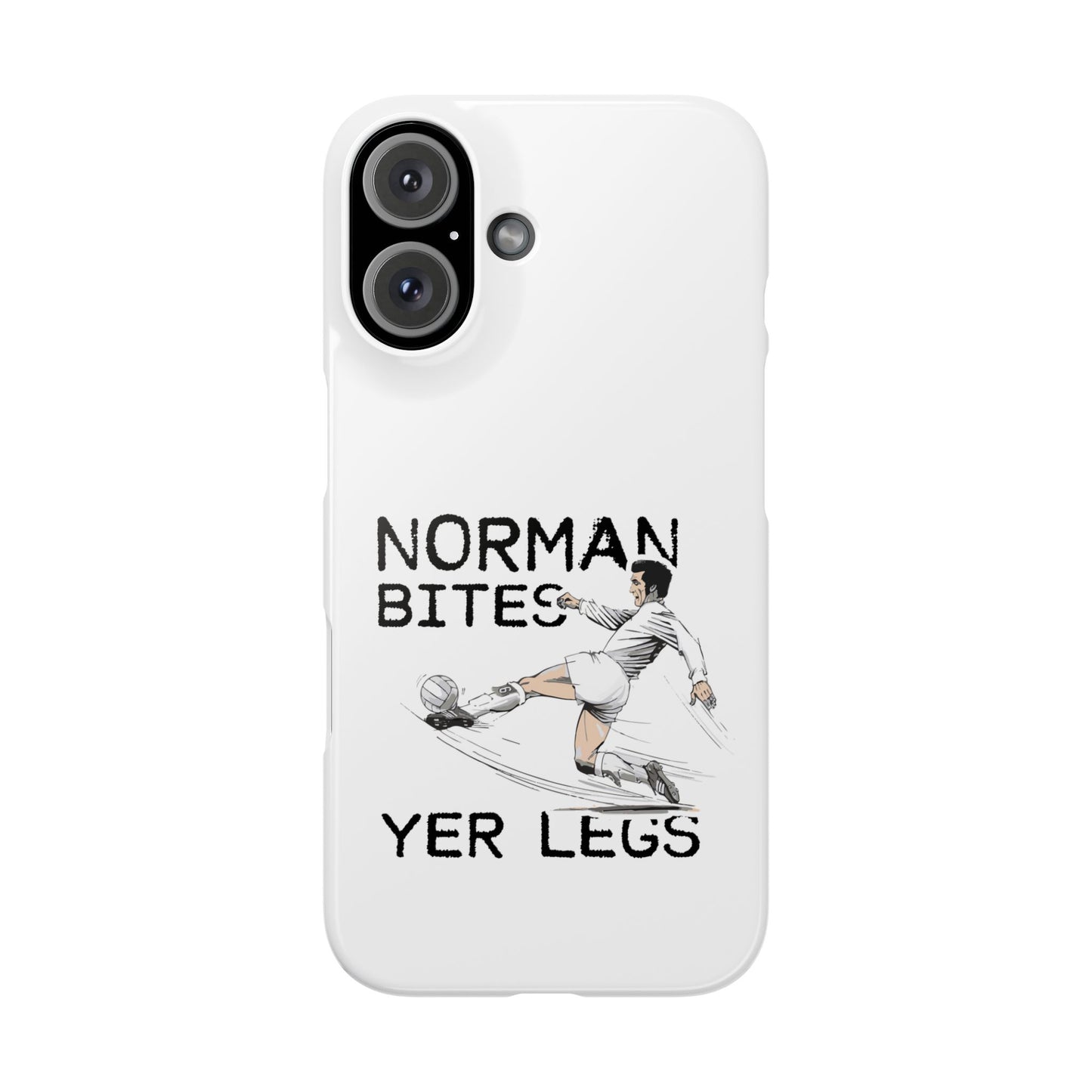 Leeds United Norman Bites "YER  LEGS" Snap Case