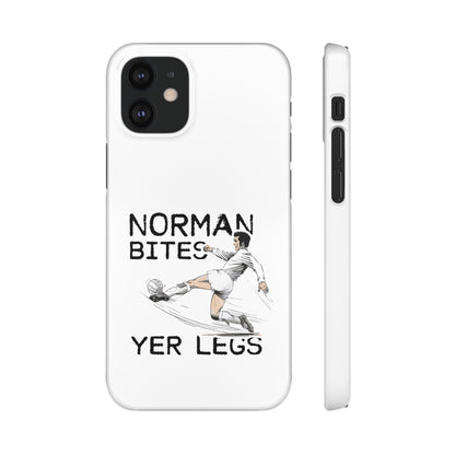 Leeds United Norman Bites "YER  LEGS" Snap Case