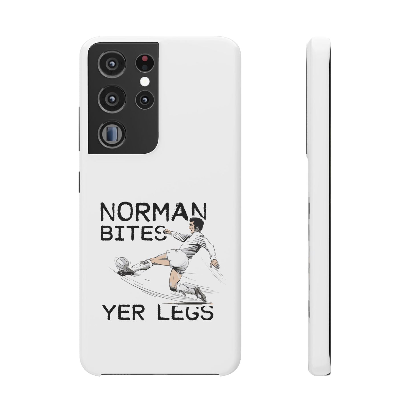 Leeds United Norman Bites "YER  LEGS" Snap Case