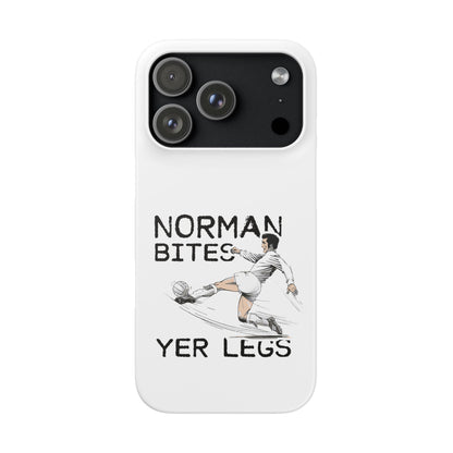 Leeds United Norman Bites "YER  LEGS" Snap Case