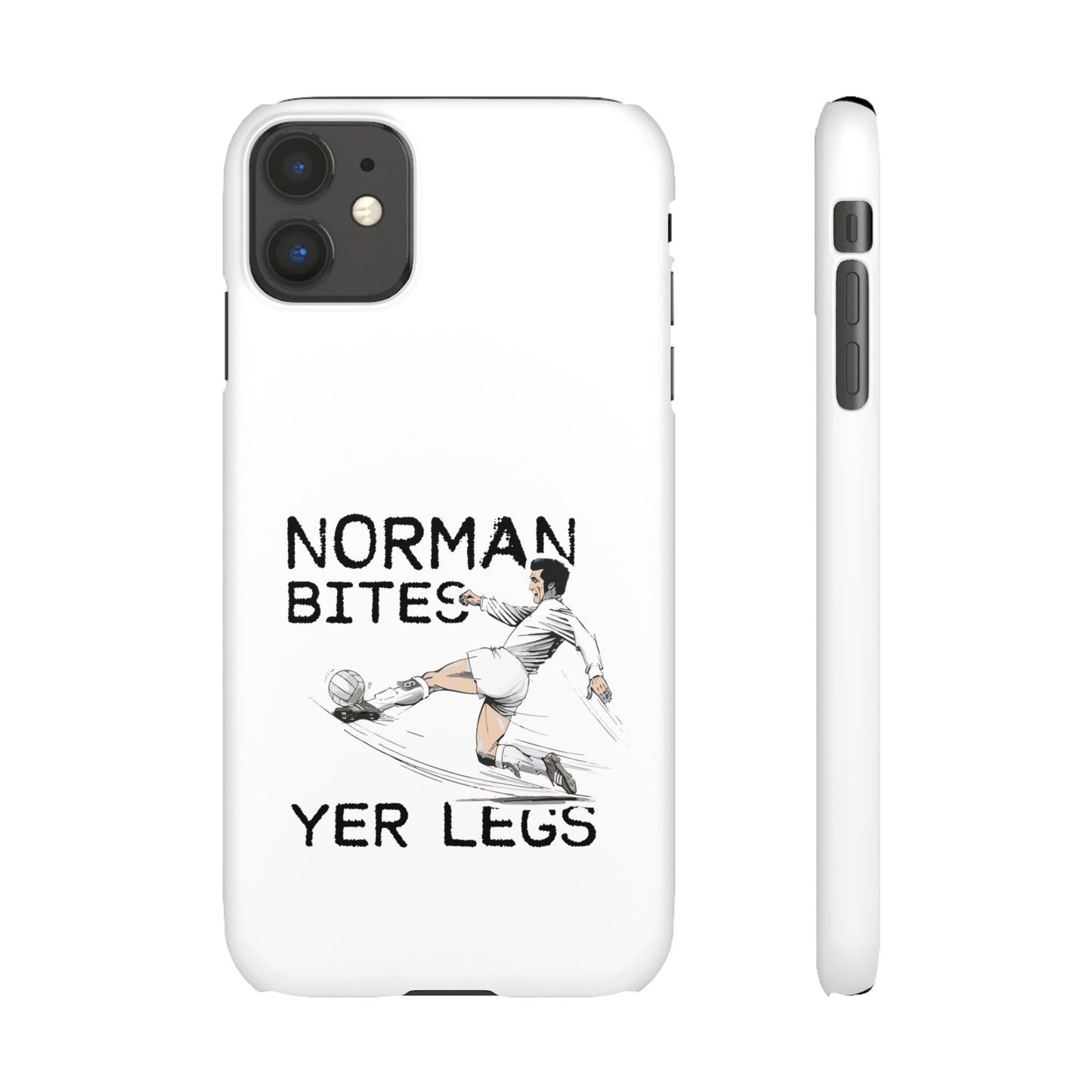 Leeds United Norman Bites "YER  LEGS" Snap Case